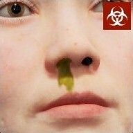鼻の膿