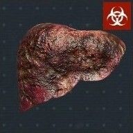 臓器の壊死